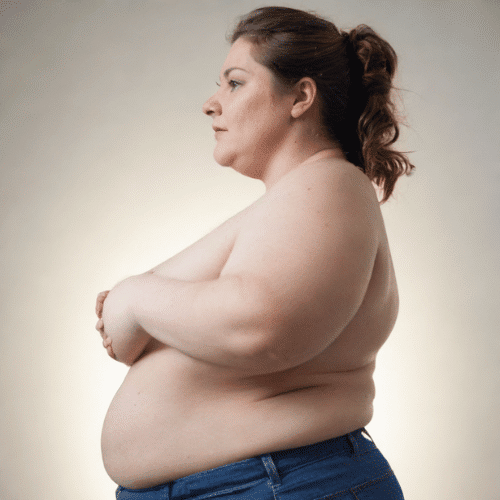 Potential Side Effects of Gastric Sleeve​